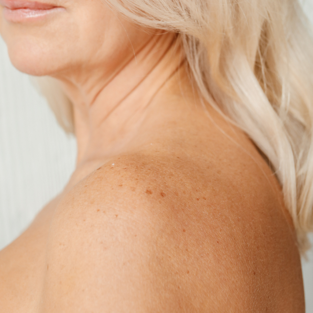 How Argan Oil Can Address Your Unique Skin Needs